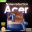 [acer official authentic]In-Ear Design|TWS Wireless Headset|Stereo|Heavy Bass|Low Latency|Comfortable Wearing(Study/Business/Sports/Running/Fitness)|Multi-Device Compatible(Mobile Phone/Tablet/Laptop)|Christmas Gift/Valentine